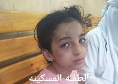 الضحية