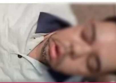 «أحمد» مصاب الفطر الأسود