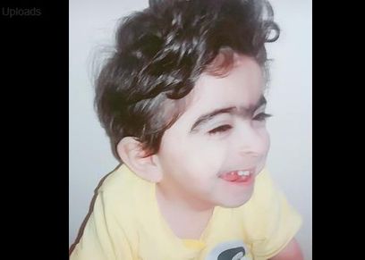 متلازمة نادرة تصيب طفل 3 سنوات