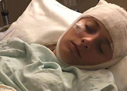 ذاكرة فتاة تعيد ضبط نفسها كل ساعتين..والأطباء عجزوا عن تفسيرها