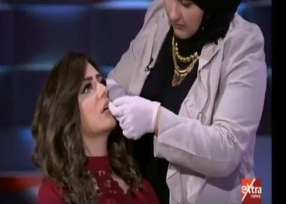 العملية