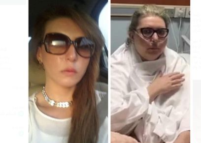 سارة أحمد مريضة الورم العضلي الليمفي