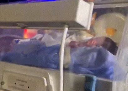 الرضيعة بعد ولادتها