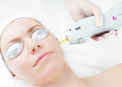 شروط إزالة الشعر بالليزر