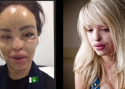 كاتى قبل وبعد عمليات التجميل