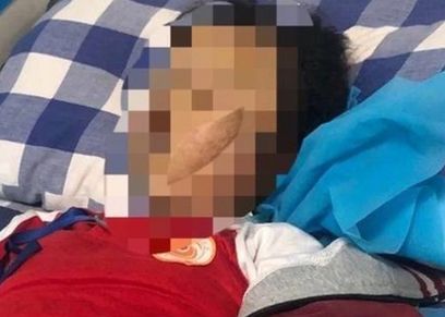 صورة التلميذة داخل المستشفى