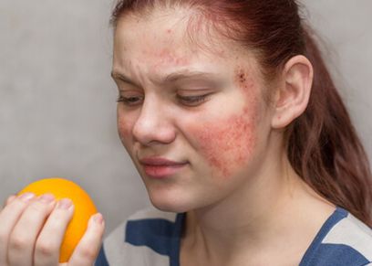 حمو النيل