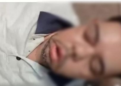 أحمد مصاب الفطر الأسود
