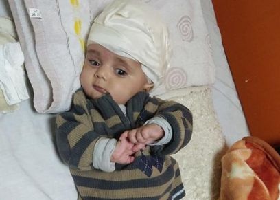 طفل يصاب بالعمى نتيجة ميكروب في الدم