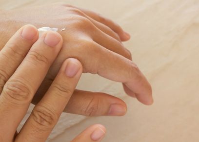 جفاف اليدين في الشتاء - تعبيرية