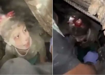 الطفلة الفلسطينية ألما