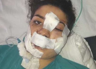 إسراء عماد ضحية عنف زوجها