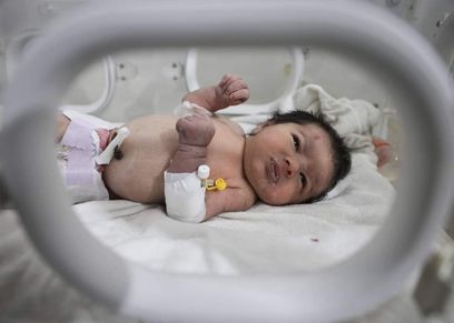 الطفلة المعجزة آية