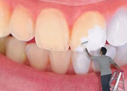 البقع البنية في الأسنان وعلاجها