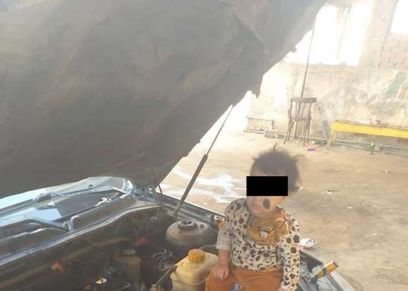 طفلة التعرية