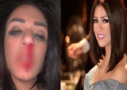 شاهيناز