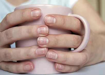 طرق التخلص من البقع البيضاء على الأظافر
