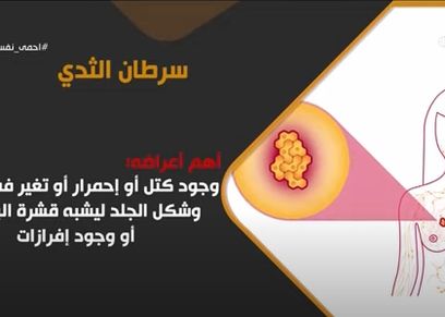 سرطان الثدي