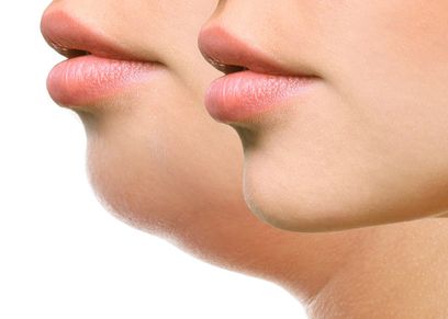 طرق التخلص من اللغلوغ المزعج