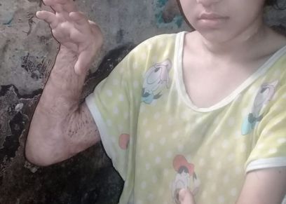 الطفلة شهد