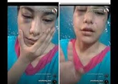 "منة عبد العزيز
