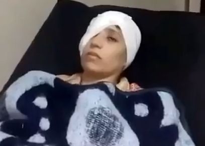 السيدة المسحولة