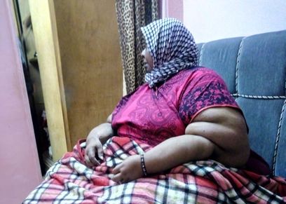 صباح مصابة بداء الفيل بالمنصورة