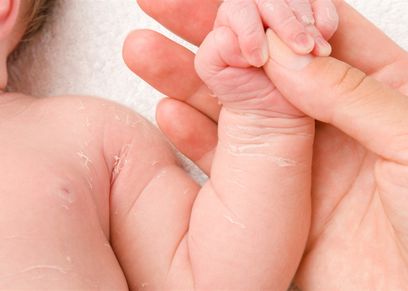 كيفية حماية جلد الأطفال حديثي الولادة