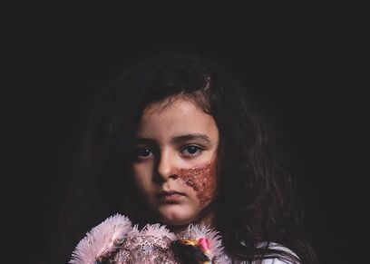 بالمكياج والدم الصناعي.. كواليس جلسة تصوير تجسد حروق الأطفال.. 
