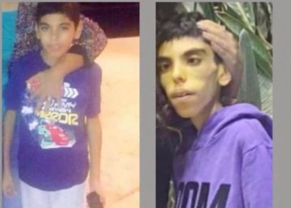الطفل مصطفى مريض الجهاز الهضمي