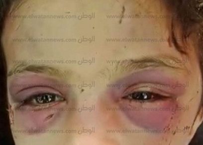 طفلة بلبيس هبة أحمد