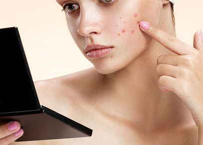 5 علاجات منزلية لعلاج البثور