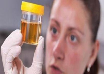 علامات تعرفيها من لون البول