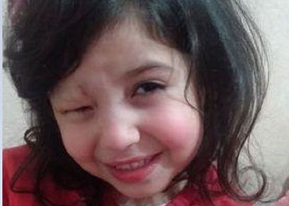 «وحمة دم» تحرم الطفلة «سما» من طفولتها