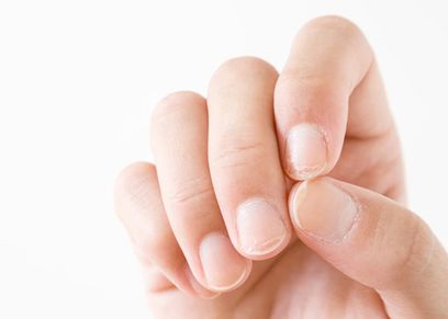 علاج تقصف الأظافر