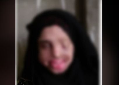 إيمان ضحية الحرق