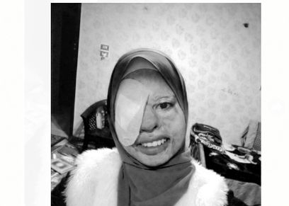 ندى الألفى تبحث عن متبرع لعلاج عينيها 