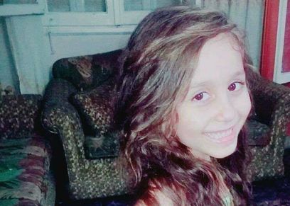 طفلة تعرضت للضرب