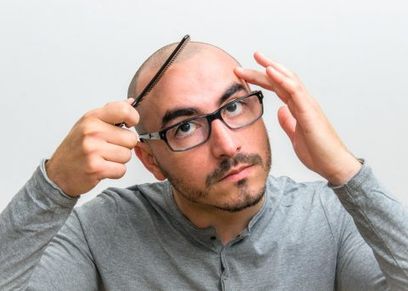 علاج الصلع عند الرجال
