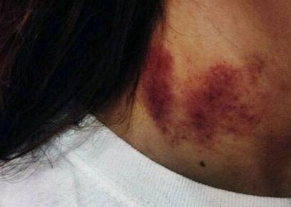 طرق إخفاء ومعالجة بصمة