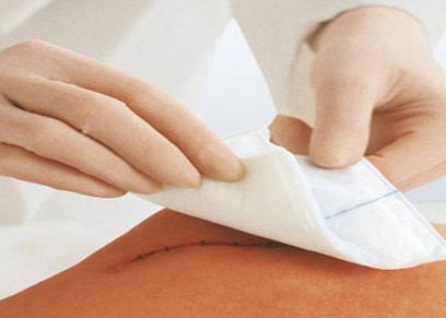 علاج الجروح
