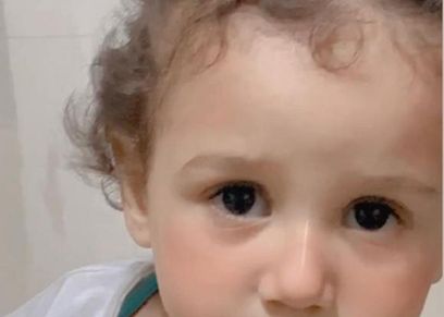 الطفلة مريم تعاني من السرطان