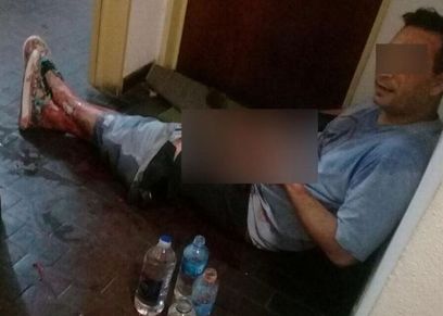 بالصور| سيدة أرجنتينية تعترف بقطع عضو صديقها الذكري: