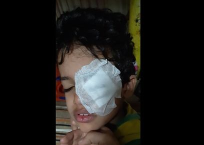 طالب يتعرض لقطع في قرنية العين