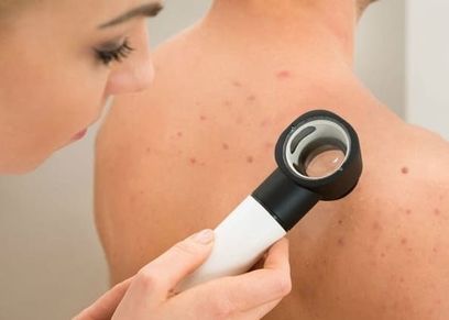  علاج حبوب الظهر والكتف للنساء