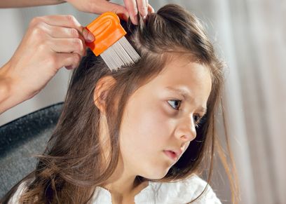 إزالة شعر الأطفال