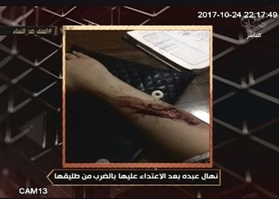 يدل نهال بعد الاعتداء عليها