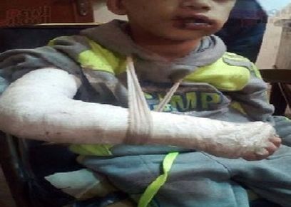 صورة أرشيفية لأحد ضحايا العنف