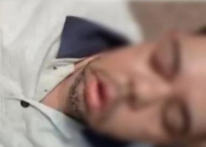 أحمد مصاب الفطر الأسود