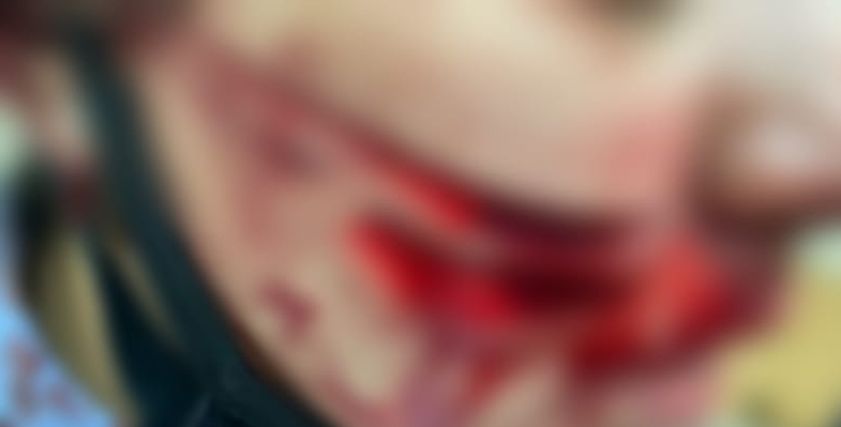 الزوجة بعد التشويه